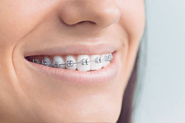 Best Traditional Braces  in Fairmont, WV